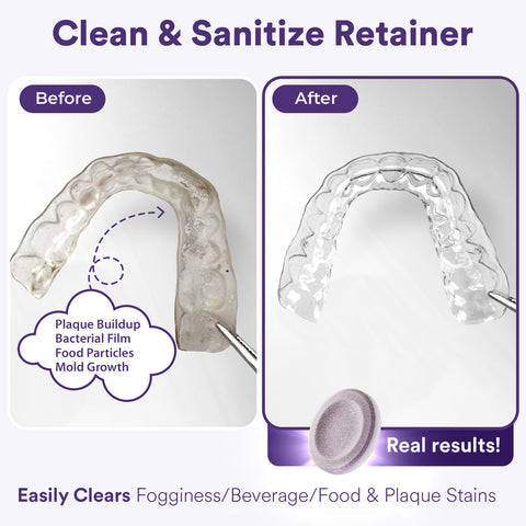 Daily Retainer & Aligner Cleaner Tablets