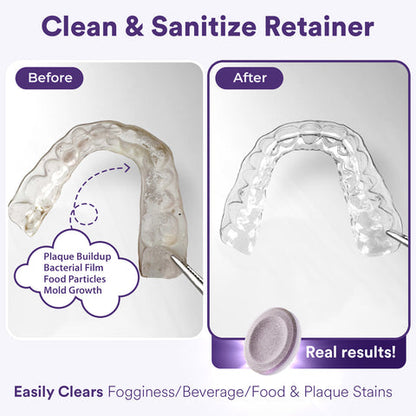 Daily Retainer & Aligner Cleaner Tablets